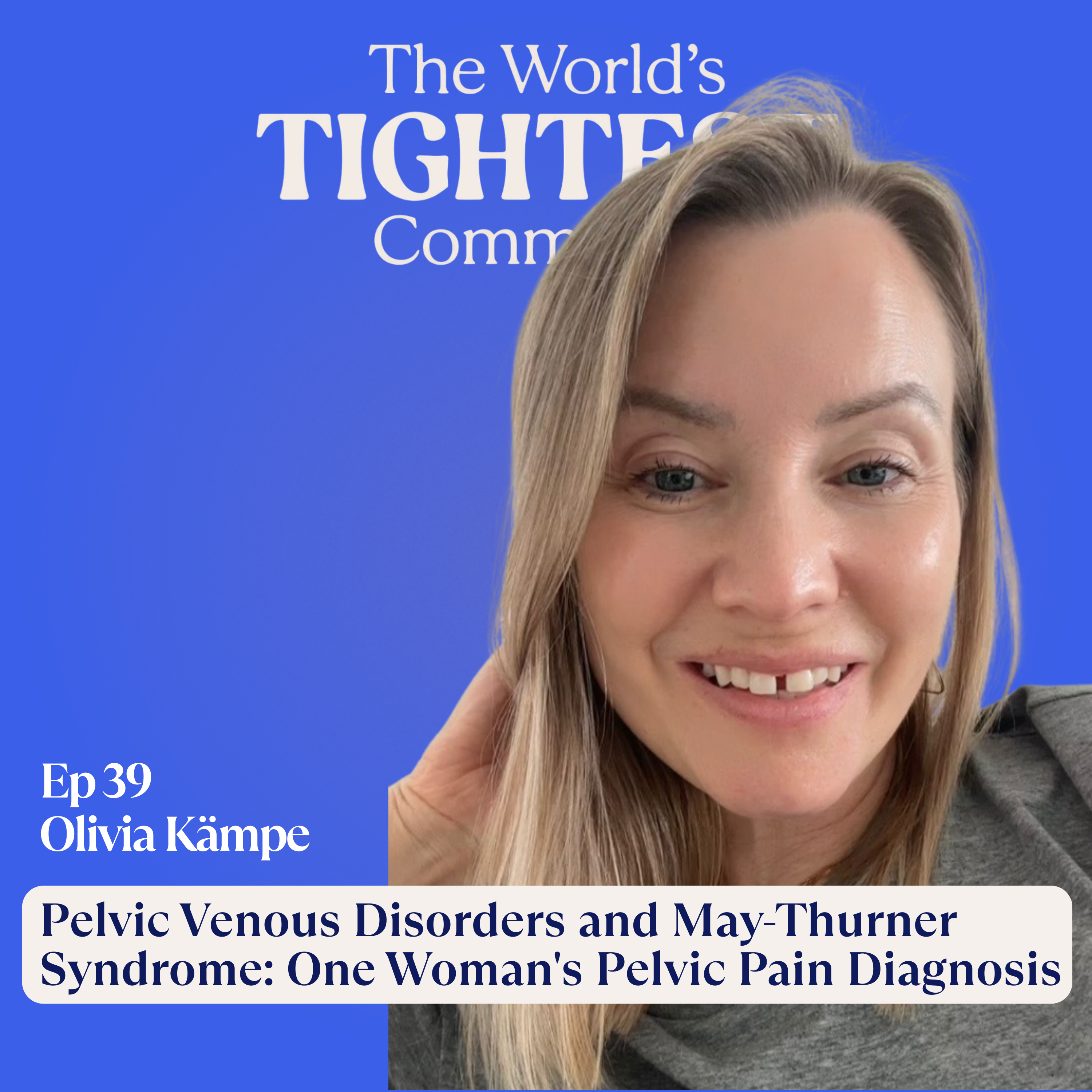 Pelvic Venous Disorders and May-Thurner Syndrome: One Woman's Pelvic Pain Diagnosis