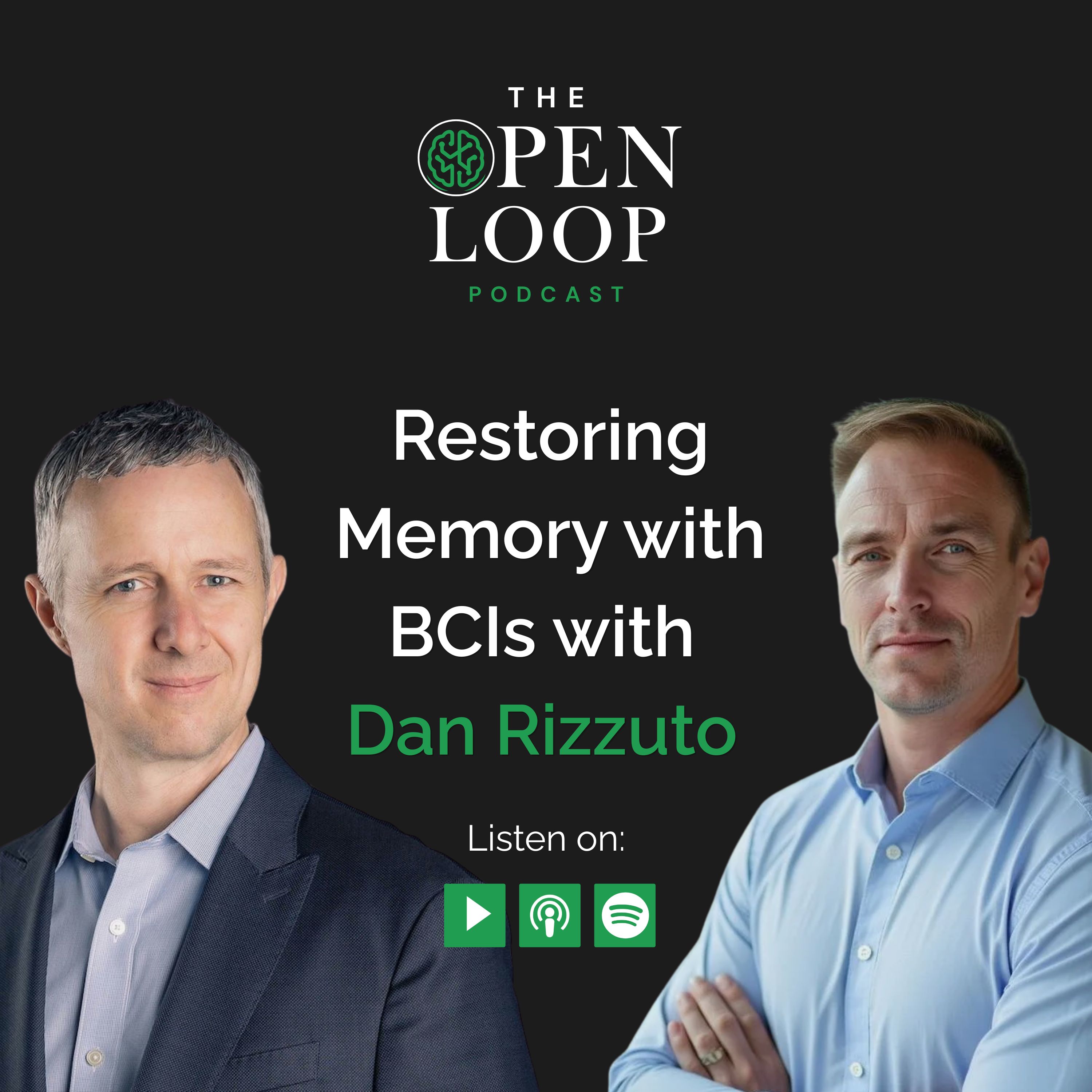 The Open Loop