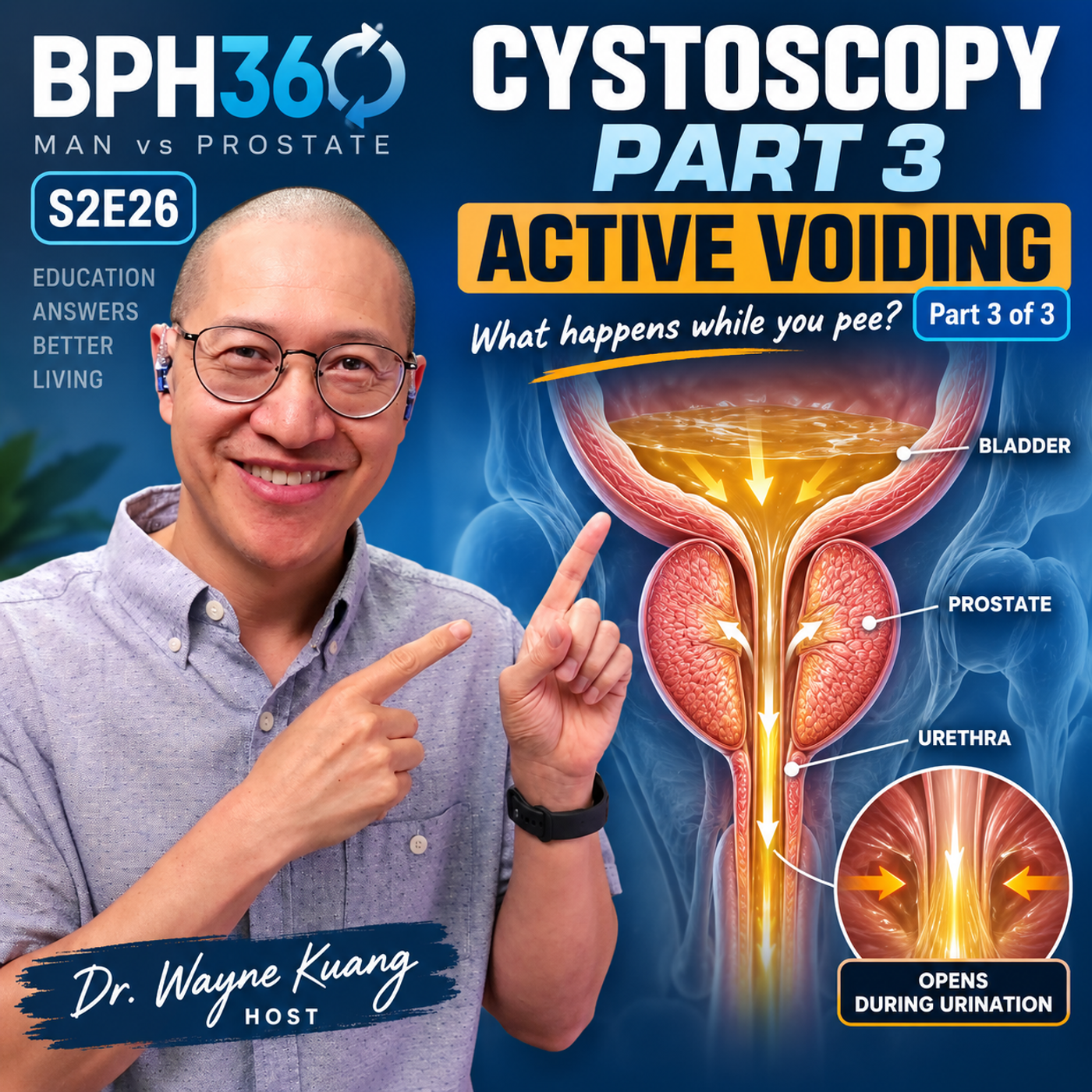 Does Your Prostate “Open Up” When You Pee with BPH? S2E26 episode artwork